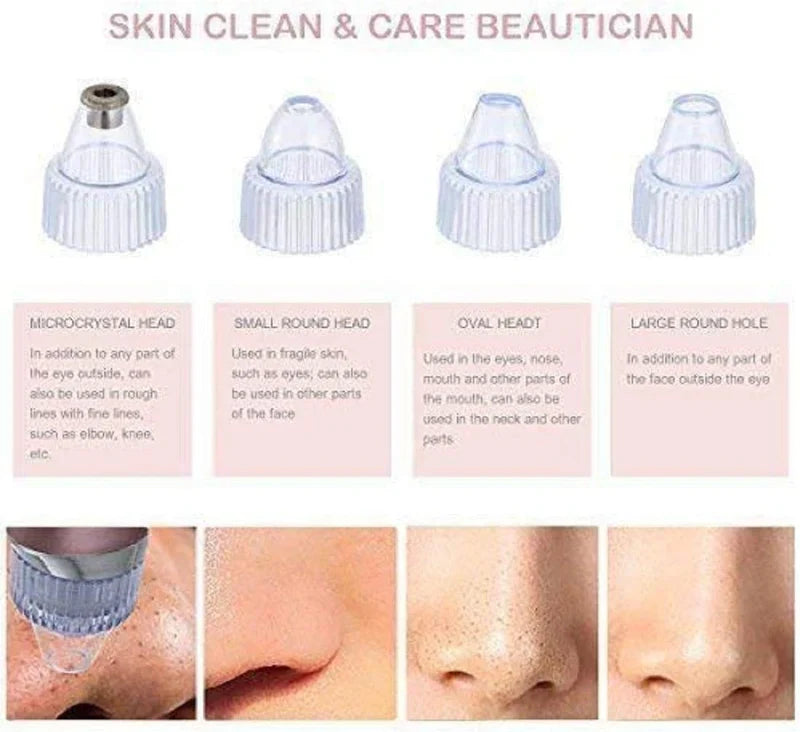 Pore Cleaning Device | Blackhead Remover Vacuum