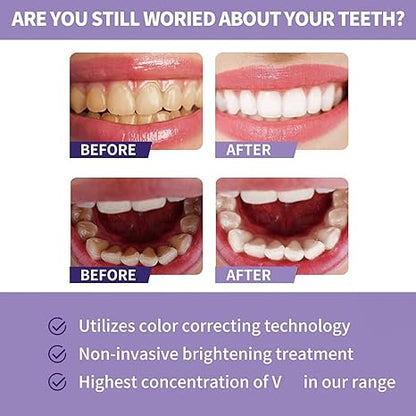 Toothpaste for Teeth Whitening | Enamel Safe Mint Gel