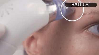 Pore Cleaning Device | Blackhead Remover Vacuum
